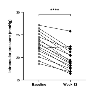 Paired Intraocular Pressure Change — Before-after · Paired t-test