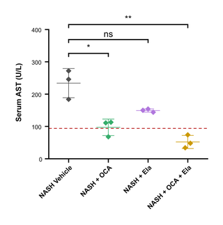 Serum AST in a Synthetic NASH Study — Scatter plot · Welch t-test